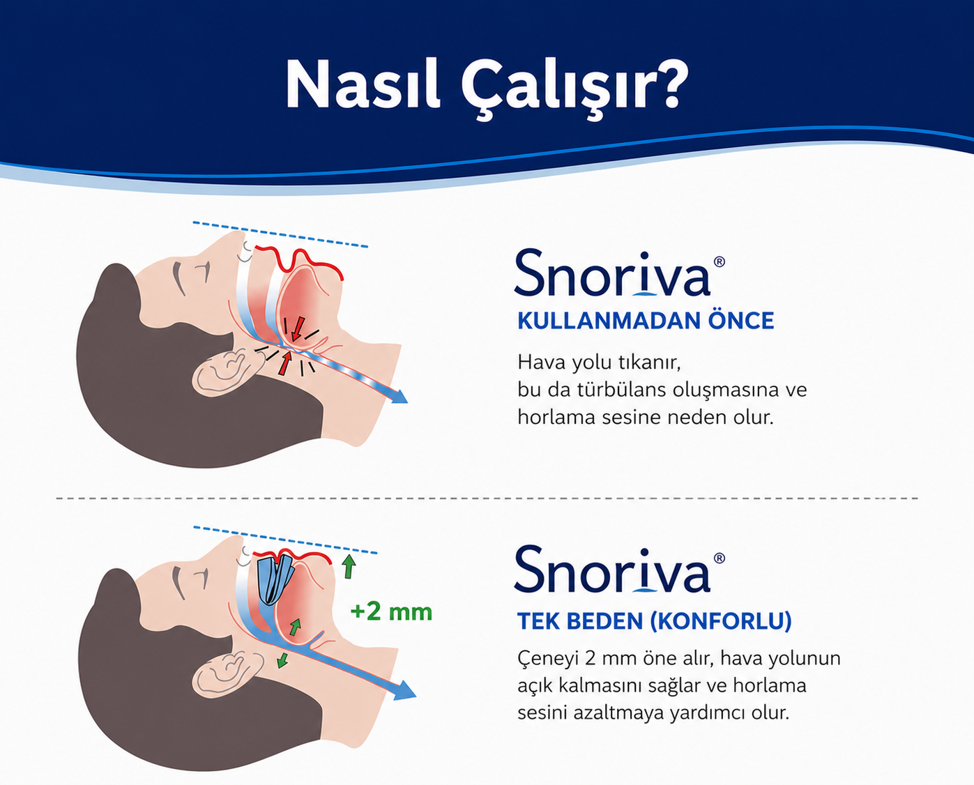 Snoriva Uyku Aparatı – Sessiz Gece Desteği