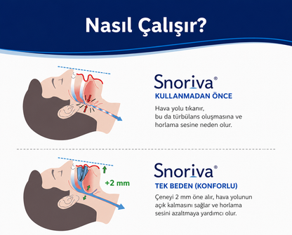 Snoriva Uyku Aparatı – Sessiz Gece Desteği